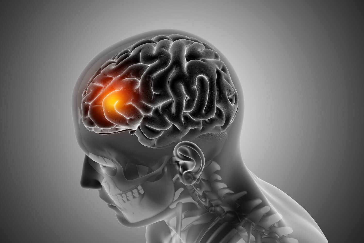 Symptoms and Severity of Brain Injuries