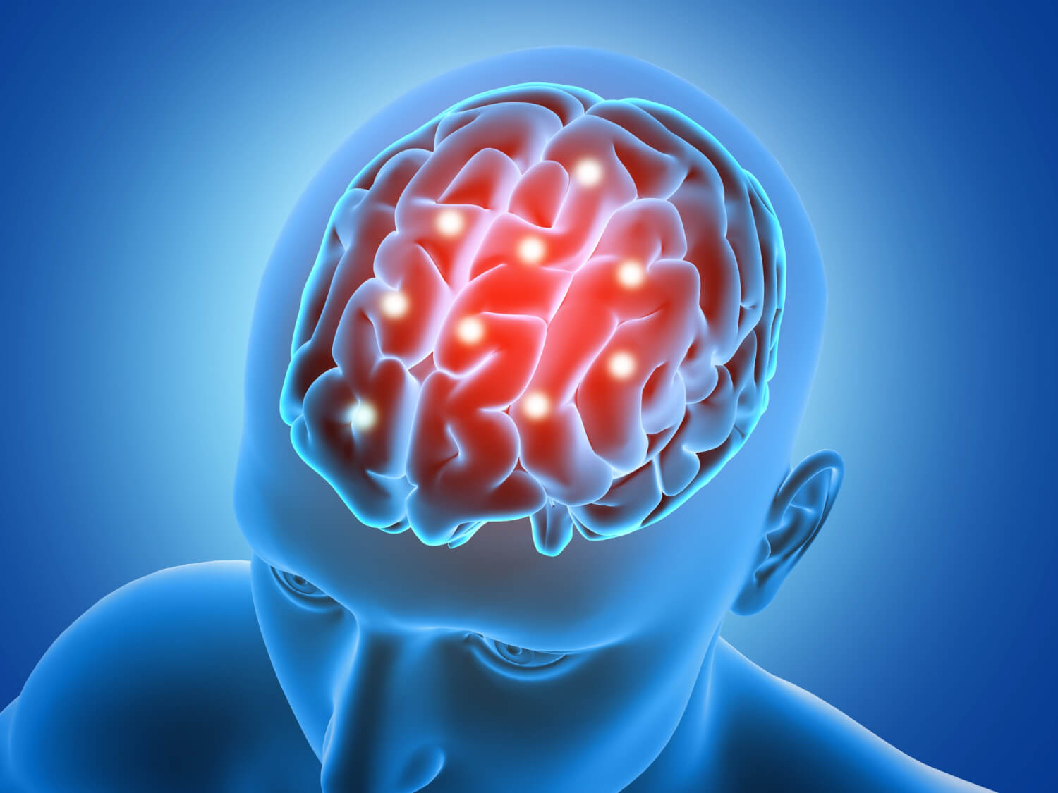 Time Limits for Filing a TBI Claim in California